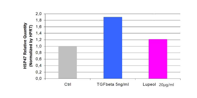 Lupinus Albus Extract.jpg Lupinus Albus Extract.jpg